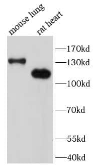 Western Blot: SRGAP2 Antibody - BSA Free [NBP3-45820] - Various lysates were subjected to SDS PAGE followed by western blot with (SRGAP2 antibody) at dilution of 1:1000