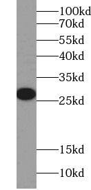 Western Blot SRA1 Antibody - BSA Free