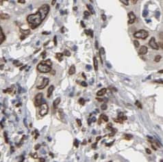 Immunohistochemistry: Spectrin beta 2 Antibody - BSA Free [NBP3-45826] - Immunohistochemistry of paraffin-embedded human lung using (Spectrin beta 2 antibody) at dilution of 1:100