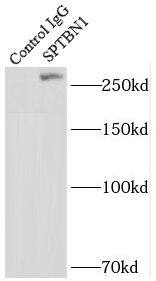 Immunoprecipitation: Spectrin beta 2 Antibody - BSA Free [NBP3-45826] - IP Result of anti-Spectrin beta 2 (IP:, 5ug; Detection: 1:600) with HEK-293 cells lysate 1000ug.