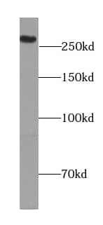 Western Blot: Spectrin beta 2 Antibody - BSA Free [NBP3-45826] - Mouse brain tissue were subjected to SDS PAGE followed by western blot with (Spectrin beta 2 antibody) at dilution of 1:300