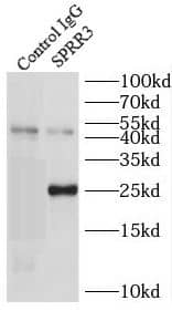 Immunoprecipitation: SPRR3 Antibody - BSA Free [NBP3-45827] - IP Result of anti-SPRR3 (IP:, 3ug; Detection: 1:500) with COLO 320 cells lysate 1720ug.