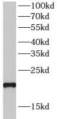 Western Blot: SPRR3 Antibody - BSA Free [NBP3-45827] - HeLa cells were subjected to SDS PAGE followed by western blot with (SPRR3 antibody) at dilution of 1:1000