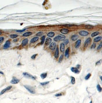Immunohistochemistry: SPRR1B Antibody - BSA Free [NBP3-45829] - Immunohistochemistry of paraffin-embedded human skin tissue slide using (SPRR1B antibody) at dilution of 1:50