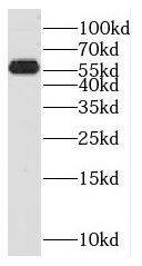 Western Blot SPPL2a Antibody - BSA Free
