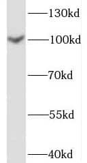 Western Blot: SPOCD1 Antibody - BSA Free [NBP3-45832] - SH-SY5Y cells were subjected to SDS PAGE followed by western blot with ( SPOCD1 Antibody) at dilution of 1:1000