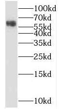 Western Blot: SPO11 Antibody - BSA Free [NBP3-45833] - Mouse testis tissue were subjected to SDS PAGE followed by western blot with (SPO11 antibody) at dilution of 1:400