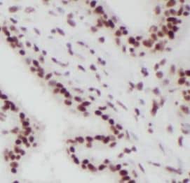 Immunohistochemistry SPIN2B Antibody - BSA Free