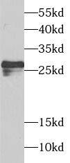 Western Blot SPIN2B Antibody - BSA Free