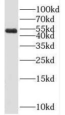 Western Blot: SPERT Antibody - BSA Free [NBP3-45838] - Mouse testis tissue were subjected to SDS PAGE followed by western blot with (SPERT antibody) at dilution of 1:1000