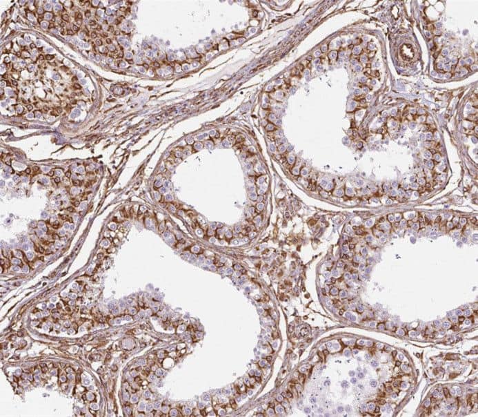 Immunohistochemistry SPATA7 Antibody - BSA Free