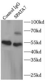 Immunoprecipitation SPATA7 Antibody - BSA Free