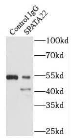Immunoprecipitation: SPATA22 Antibody - BSA Free [NBP3-45843] - IP Result of anti-SPATA22 (IP:, 3ug; Detection: 1:500) with mouse testis tissue lysate 4800ug.