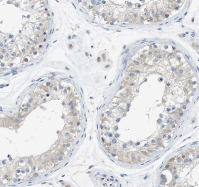 Immunohistochemistry SPATA19 Antibody - BSA Free
