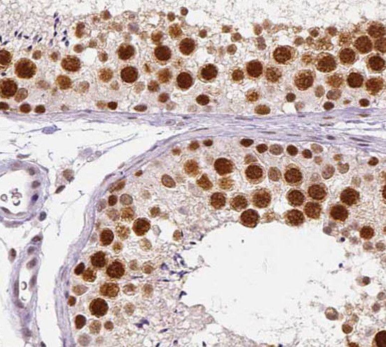 Immunohistochemistry SPANX-D Antibody - BSA Free