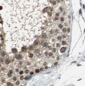 Immunohistochemistry SPANXA1 Antibody - BSA Free