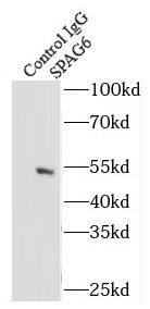 Immunoprecipitation: SPAG6 Antibody - BSA Free [NBP3-45855] - IP Result of anti-SPAG6 (IP:, 3ug; Detection: 1:300) with mouse testis tissue lysate 4000ug.