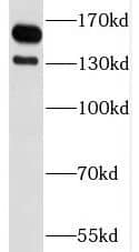Western Blot: Astrin Antibody - BSA Free [NBP3-45856] - HeLa cells were subjected to SDS PAGE followed by western blot with (Astrin antibody) at dilution of 1:1000