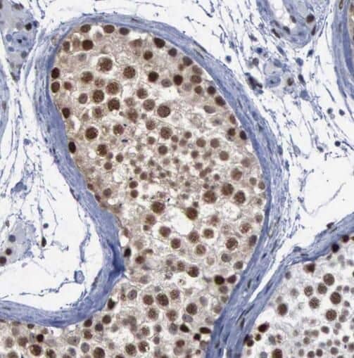 Immunohistochemistry: Astrin Antibody - BSA Free [NBP3-45856] - Immunohistochemistry of paraffin-embedded human testis using (Astrin antibody) at dilution of 1:100