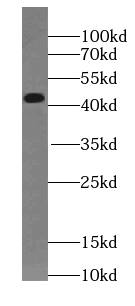 Western Blot SPAG4L Antibody - BSA Free