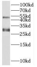 Western Blot SPACA3 Antibody - BSA Free