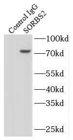 Immunoprecipitation: SORBS2 Antibody - BSA Free [NBP3-45861] - IP Result of anti-SORBS2 (IP:, 4ug; Detection: 1:500) with mouse heart tissue lysate 4000ug.
