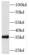 Western Blot: Solo Antibody - BSA Free [NBP3-45862] - HeLa cells were subjected to SDS PAGE followed by western blot with (Solo antibody) at dilution of 1:500