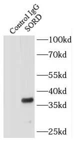 Immunoprecipitation: Solo Antibody - BSA Free [NBP3-45862] - IP Result of anti-Solo (IP:, 4ug; Detection: 1:1000) with mouse liver tissue lysate 4000ug.