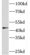 Western Blot: Sorting Nexin 32 Antibody - BSA Free [NBP3-45865] - HeLa cells were subjected to SDS PAGE followed by western blot with ( Sorting Nexin 32 Antibody) at dilution of 1:600