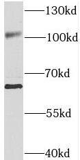Western Blot: SNX25 Antibody - BSA Free [NBP3-45866] - Jurkat cells were subjected to SDS PAGE followed by western blot with (SNX25 antibody) at dilution of 1:500