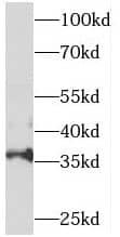 Western Blot: SNX20 Antibody - BSA Free [NBP3-45867] - COLO 320 cells were subjected to SDS PAGE followed by western blot with (SNX20 antibody) at dilution of 1:300