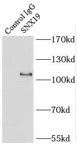 Immunoprecipitation: SNX19 Antibody - BSA Free [NBP3-45868] - IP Result of anti-SNX19 (IP:, 4ug; Detection: 1:500) with Raji cells lysate 1600ug.