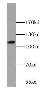 Western Blot: SNX19 Antibody - BSA Free [NBP3-45868] - Raji cells were subjected to SDS PAGE followed by western blot with (SNX19 antibody) at dilution of 1:500
