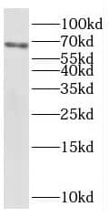 Western Blot: SNX18 Antibody - BSA Free [NBP3-45869] - HL-60 cells were subjected to SDS PAGE followed by western blot with (SNX18 antibody) at dilution of 1:1000