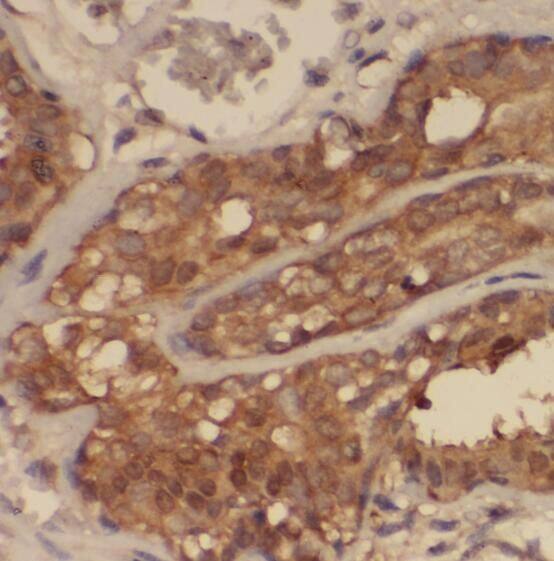 Immunohistochemistry SNRPF Antibody - BSA Free