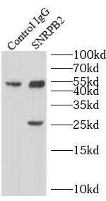 Immunoprecipitation SNRPB2 Antibody - BSA Free