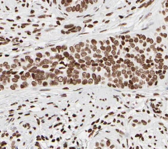 Immunohistochemistry SNRPB2 Antibody - BSA Free