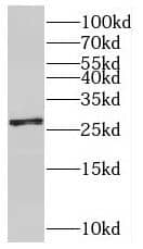 Western Blot SNRPB2 Antibody - BSA Free