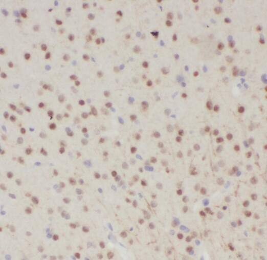 Immunohistochemistry: SNRNP48 Antibody - BSA Free [NBP3-45875] - Immunohistochemistry of paraffin-embedded human brain slide using (SNRNP48 Antibody) at dilution of 1:50