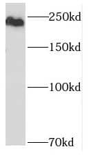 Western Blot: ASCC3L1 Antibody - BSA Free [NBP3-45876] - HeLa cells were subjected to SDS PAGE followed by western blot with (ASCC3L1 antibody) at dilution of 1:1000