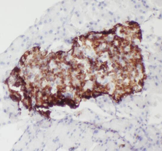 Immunohistochemistry: SMYD4 Antibody - BSA Free [NBP3-45879] - Immunohistochemistry of paraffin-embedded human pancreas using (SMYD4 antibody) at dilution of 1:50