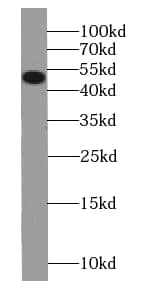 Western Blot: SMTNL1 [p Ser301] Antibody - BSA Free [NBP3-45881] - Mouse bladder tissue were subjected to SDS PAGE followed by western blot with (SMTNL1 antibody) at dilution of 1:500