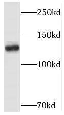 Western Blot: SMC5 Antibody - BSA Free [NBP3-45888] - HeLa cells were subjected to SDS PAGE followed by western blot with (SMC5 antibody) at dilution of 1:500