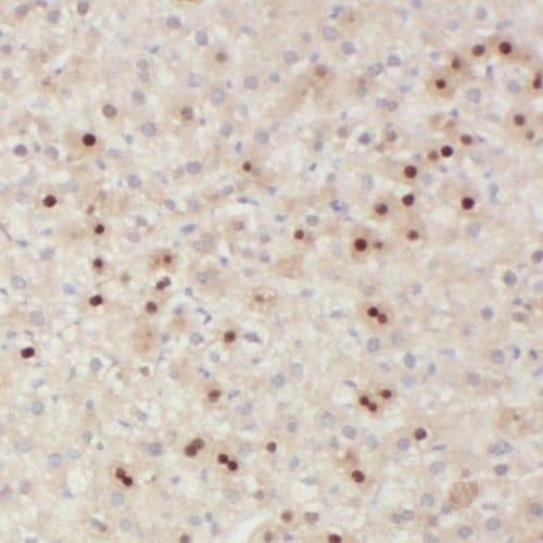 Immunohistochemistry SMAP2 Antibody - BSA Free