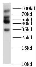 Western Blot: SLMAP Antibody - BSA Free [NBP3-45891] - Mouse heart tissue were subjected to SDS PAGE followed by western blot with ( SLMAP Antibody) at dilution of 1:600