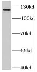 Western Blot: SLITRK3 Antibody - BSA Free [NBP3-45892] - Mouse brain tissue were subjected to SDS PAGE followed by western blot with (SLITRK3 antibody) at dilution of 1:200