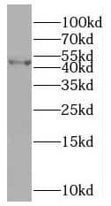 Western Blot: SLFNL1 Antibody - BSA Free [NBP3-45893] - COLO 320 cells were subjected to SDS PAGE followed by western blot with (SLFNL1 antibody) at dilution of 1:800