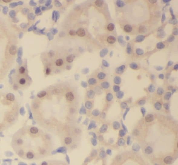 Immunohistochemistry: SLFNL1 Antibody - BSA Free [NBP3-45893] - Immunohistochemistry of paraffin-embedded human kidney using (SLFNL1 antibody) at dilution of 1:100