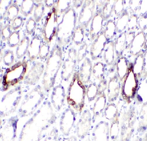 Immunohistochemistry SLCO4C1 Antibody - BSA Free