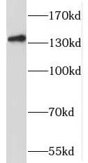 Western Blot: SLC9A11 Antibody - BSA Free [NBP3-45898] - Mouse liver tissue were subjected to SDS PAGE followed by western blot with (SLC9A11 antibody) at dilution of 1:500
